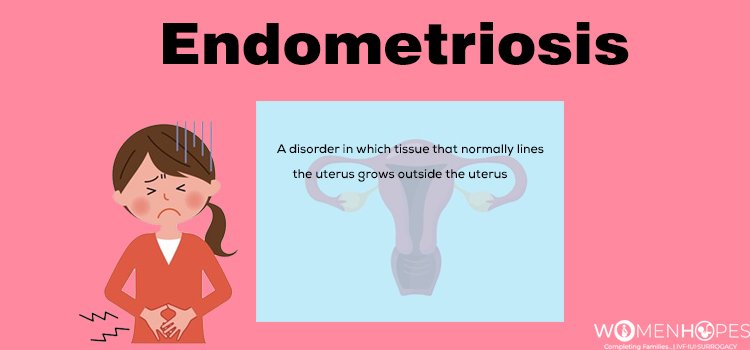 Endometriosis: Causes, Symptoms and Treatment